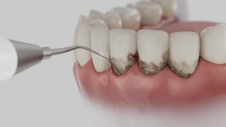 Reliable Dental contractor in Kingman, KS by Smile Center Dentistry